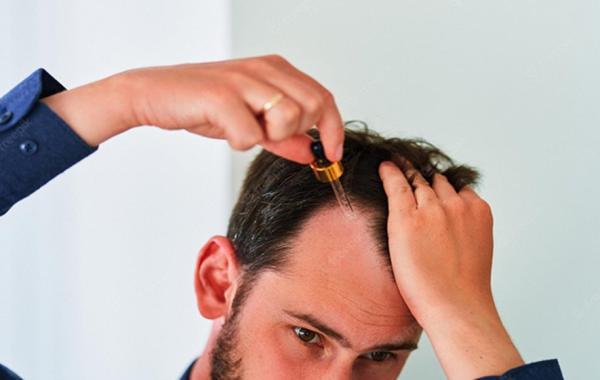 لوسیون مو چیست؛ آیا استفاده از آن تأثیری در بهبود شرایط مو دارد؟